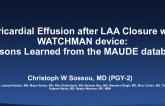 Pericardial Effusion After Left Atrial Appendage Closure: Lessons Learned From the MAUDE Database