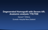 Anatomic Analysis TTE/TEE