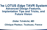 Advanced Design Features, Implantation Tips and Tricks, and Future Vision