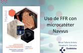 Uso de FFR con microcatéter Navvus