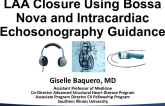 LAA Closure in a Completely Awake Patient Using BossaNova and Intracardiac Echosonography Guidance