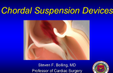 Chordal Suspension Devices