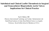 Prevention and Management of Bioprosthetic Valve Thrombosis