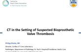 CT in the Setting of Suspected Bioprosthetic Valve Thrombosis