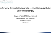 When Transfemoral Access Is Problematic — Facilitation With Intravascular Balloon Lithotripsy