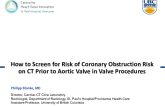 How to Screen for Risk of Coronary Obstruction Risk on CT Prior to Aortic Valve-in-Valve Procedures