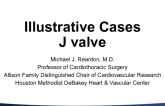 Illustrative Cases