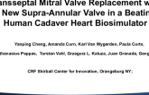 Transseptal Mitral Valve Replacement With a New Supra-Annular Valve in a Beating Human Cadaver Heart Biosimulator