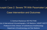 Case Intervention and Outcomes