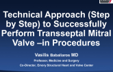 Technical Approach (Step-by-Step) to Successfully Perform Transseptal Mitral Valve-In Procedures