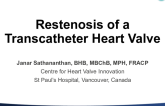 Restenosis of a Transcatheter Aortic Valve