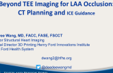 Beyond TEE Imaging for LAA Occlusion: CT Planning and ICE Guidance
