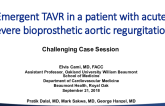 Emergent TAVR in a Patient Acute Severe Bioprosthetic AI and Multiorgan Dysfunction