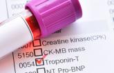 Tool May Ease Use of High-Sensitivity Troponin for Acute MI Diagnosis