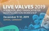 Live Valves 2019