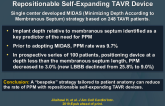 Minimizing Permanent Pacemaker (PPM) After a Repositionable Self-Expanding TAVR Device