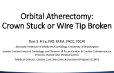 Orbital Atherectomy: Crown Stuck or Wire Tip Broken