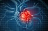 New ‘Chronic Coronary Syndrome’ Guidelines Stress There’s Nothing Stable About CAD 