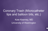 Coronary Trash (Microcatheter tips and balloon bits, etc.)