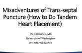 Misadventures of Trans-septal Puncture (How to Do Tandem Heart Placement)