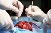 Meta-analysis Supports Surgical LAA Occlusion During Cardiac Surgery, but Flaws Found