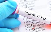 High-Sensitivity Troponin Performs Well Against Traditional Tools for 30-Day MACE Prediction