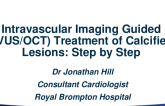 Intravascular Imaging-Guided (IVUS/OCT) Treatment of Calcified Lesions: Step-by-Step