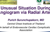 Unusual Situation During Transradial Intervention