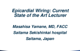 Epicardial Wiring: Current State of the Art