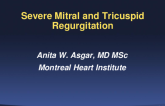 Case Presentation:Severe DMR and Severe TR