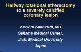 Halfway Rotational Atherectomy in Severely Calcified Coronary Lesions