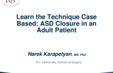 Learn the Technique (Case Based): ASD Closure in an Adult Patient