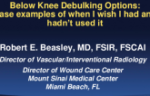 Below Knee Debulking Options: Case Examples of When I Wish I Had and Hadn't Used it