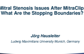 Mitral Stenosis Issues After MitraClip: What Are the Stopping Boundaries? (With Case Examples)