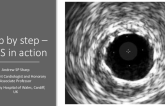 Step-by-Step IVUS: From Pre-Intervention Through Stent Optimization to Assessment of Complications