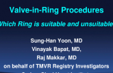 Valve-in-Ring (Mitral): Acute and Long-Term Outcomes
