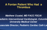 A Fontan Patient Who Had a Thrombus