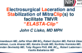 TCT 90: Electrosurgical LAceration and STAbilization of a MitraClip (ELASTA-Clip)