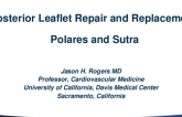 Posterior Leaflet Repair and Replacement: Polares and Sutra — Device Description, Results, and Ongoing Studies