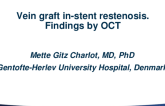 Case #7: Vein Graft ISR — Findings by OCT