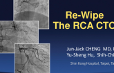 Taiwan Presents: Re-Wipe the RCA CTO