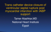 Ventricular Septal Rupture Post-Myocardial Infarction: Transcatheter Device Closure Assissted With Intra-Aortic Ballooon Pump