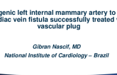 Case 3 (C): Iatrogenic Left Internal Mammary Artery to Great Cardiac Vein Fistula Successfully Treated With Vascular Plug