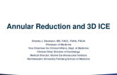 Annular Reduction and 3D ICE