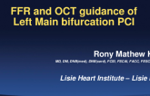 FFR and OCT Guidance of Left Main Bifurcation PCI