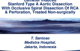 Indonesia Presents: Catheter Induced Stanford Type A Aortic Dissection With Occlusive Spiral Dissection of RCA and Perforation, Treated Non-Surgically