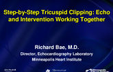 Step-by-Step Tricuspid Clipping: Echo and Intervention Working Together
