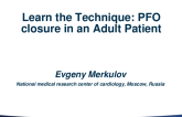 Learn the Technique (Case-Based): PFO Closure in an Adult Patient