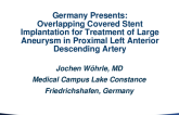 Germany Presents: Overlapping Covered Stent Implantation for Treatment of Large Aneurysm in Proximal Left Anterior Descending Artery