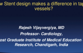 How Stent Design Makes a difference in Tapered Vessels?